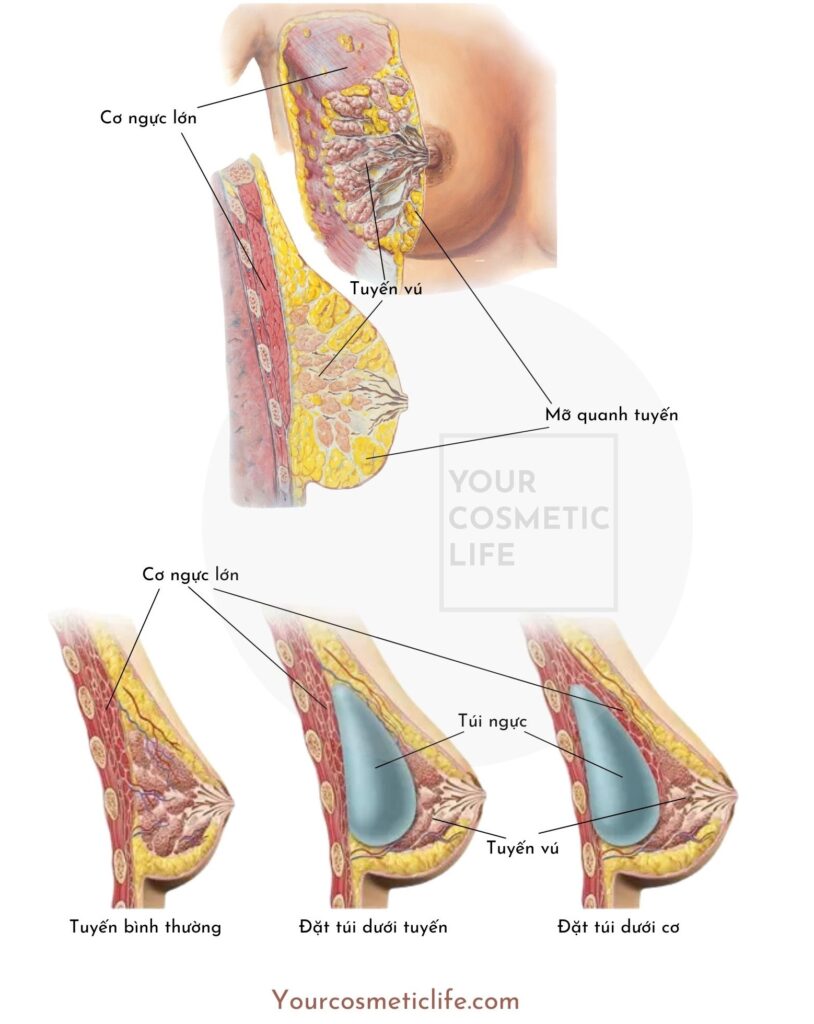 Nâng ngực cần biết gì?