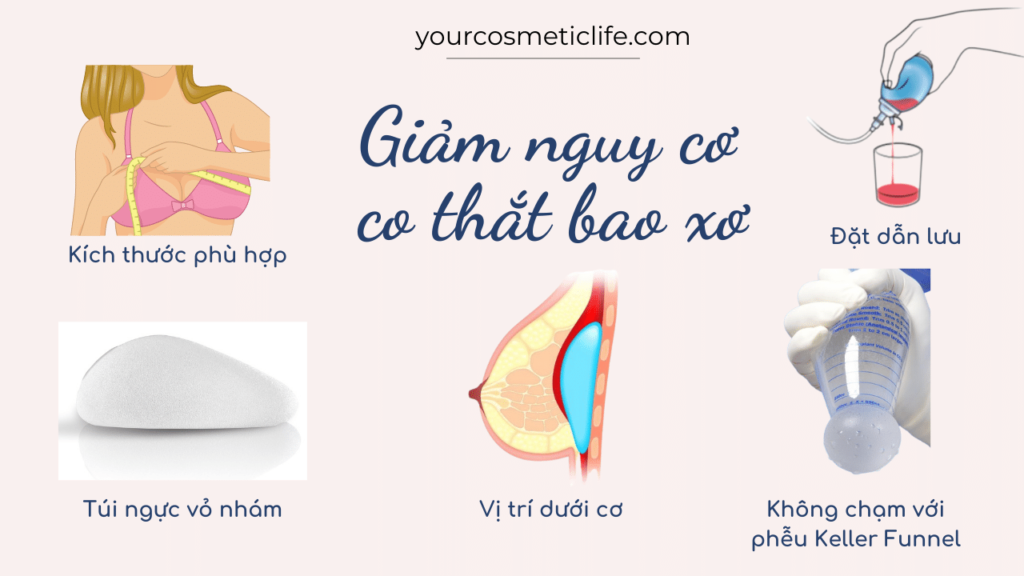 Giảm nguy cơ co thắt bao xơ