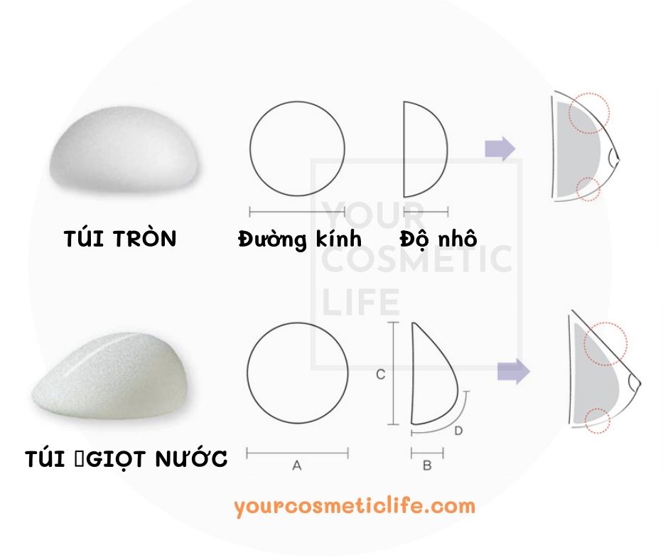 Kích thước túi nâng ngực